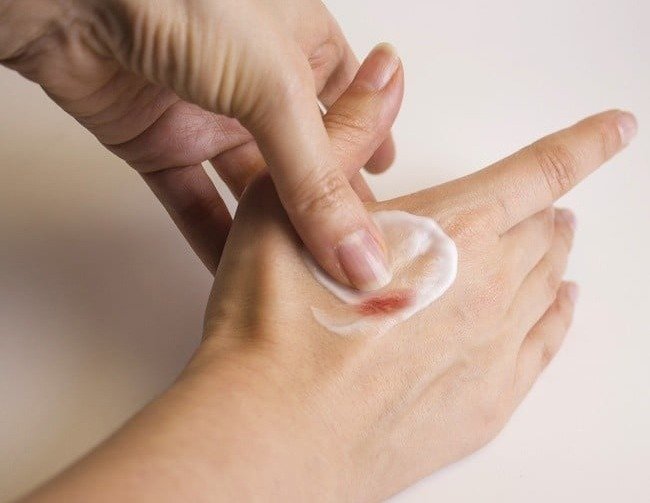 Dermatoloji Uzmanı Dr. Bilge Ateş konu hakkında bilgiler verdi.  Yara da vücudumuzda yarattığı