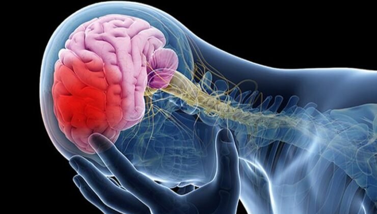 FELÇ GEÇİRME DURUMLARINA SON DERECE DİKKAT! Tamamlayıcı Tıp Hekimi ve Holistik Tıp Uzmanı Dr. Dinçer Erdinç