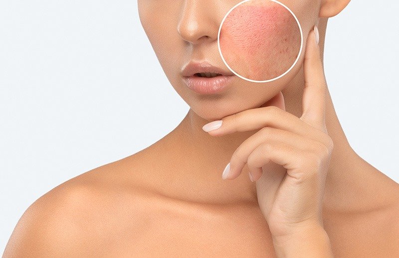 Kök hücre tedavisi geçmişten günümüze birçok hastalığın tedavisinde kullanılmıştır. Ancak