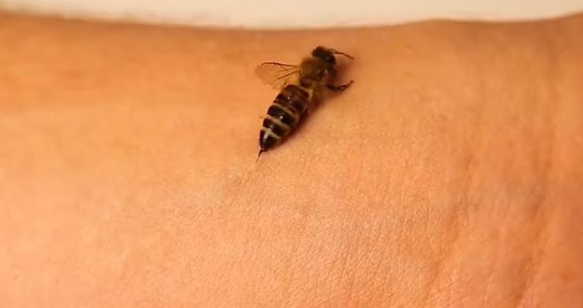 Bal arıların sokması, insanların canını neden çok fazla acıtır? Rahatsız