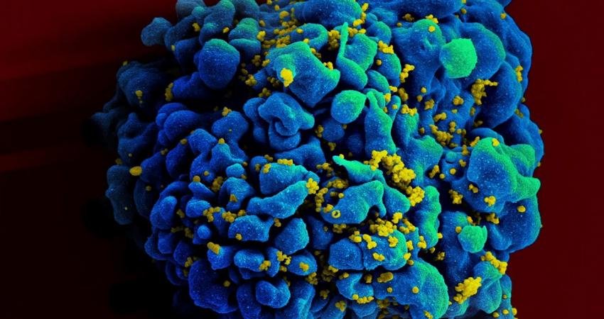 Çağımızın hastalığı olarak bilinen HIV'den tamamen kurtulan kişi sayısı bugüne