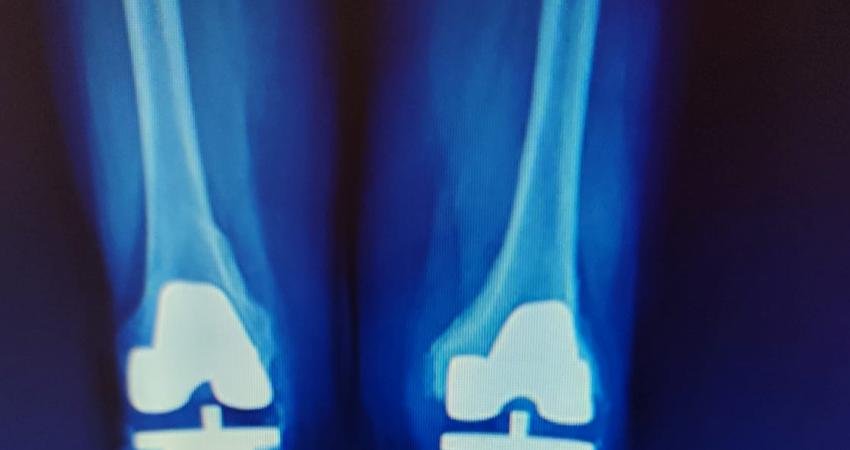 Tüm Ortopedi ve Beyin Cerrahi Bayileri Derneği, (TOBDER), “Devletin belirlediği