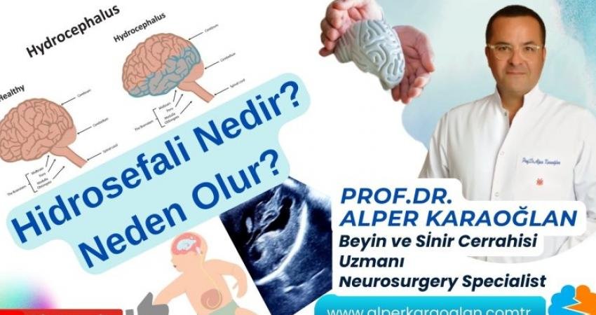 Bu makalemizde Hidrosefali nedir ve neden olur bundan bahsedeceğiz. 