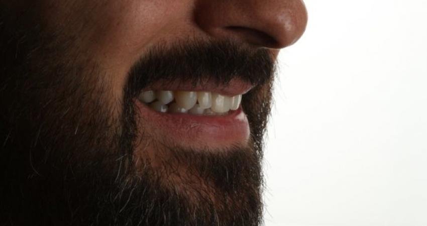 Ortodontik tedaviniz sırasında dikkat etmeniz gereken kıymetli bahisleri paylaşıyorum.