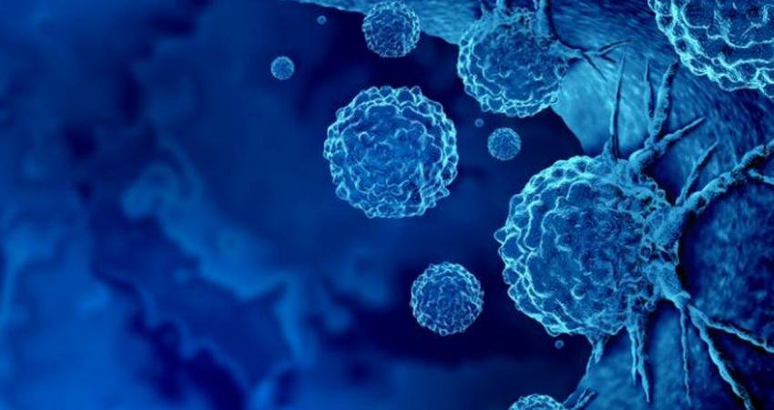 Yeni bir araştırma, 50 yaş altı kişilerde görülen kanser vakalarının