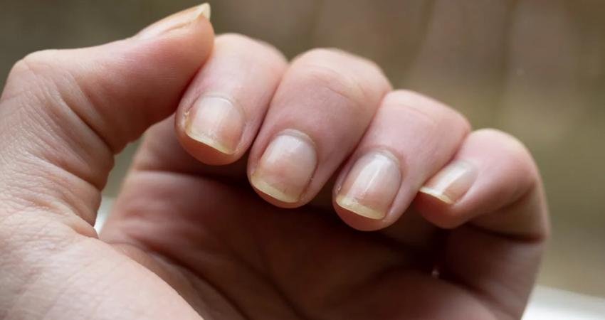 Elleriniz, sağlığınız hakkında neler söylüyor? Ellerinizde ortaya çıkan bazı belirtiler,