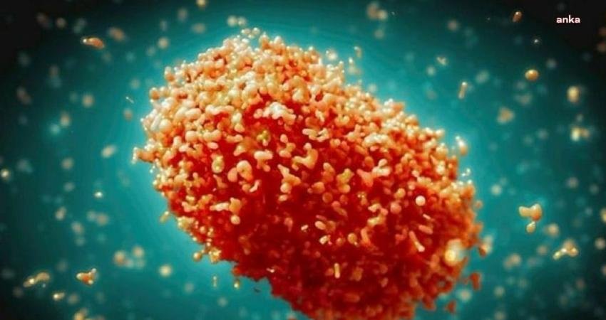 Afrika’dan sonra ilk maymun çiçeği vakasının İsveç’te tespit edilmesinin ardından