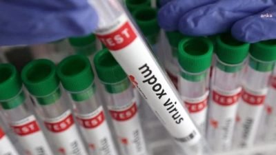 Yeni bir M çiçeği varyantı salgınından etkilenen Afrika ülkeleri, hala