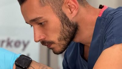 Saç ekimi, artık sadece fiziksel görünümü düzeltme amacı taşıyan bir