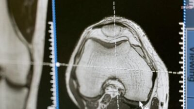 İngiltere Ulusal Sağlık Servisi (National Health Service) İcra Kurulu Başkanı