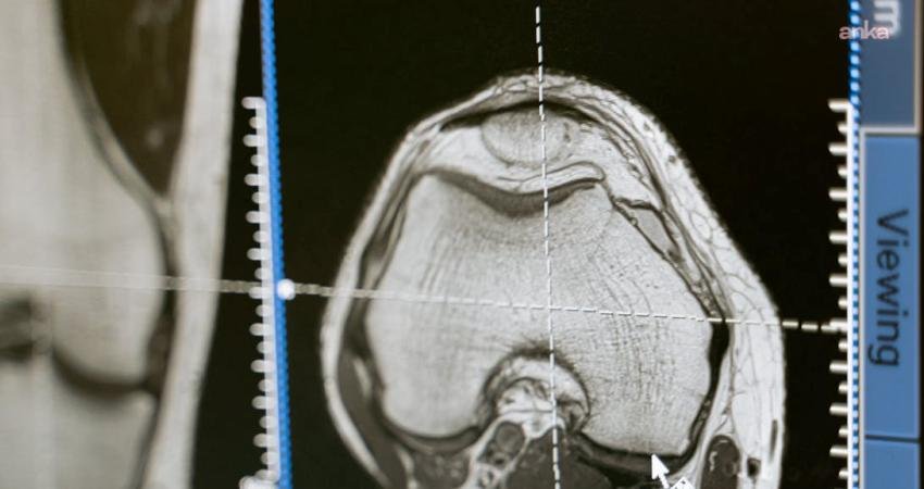 İngiltere Ulusal Sağlık Servisi (National Health Service) İcra Kurulu Başkanı